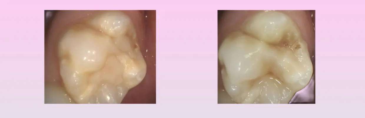 Chalky Teeth Banner