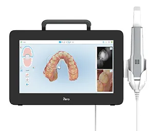 iTero digital scanner iTero digital scanner